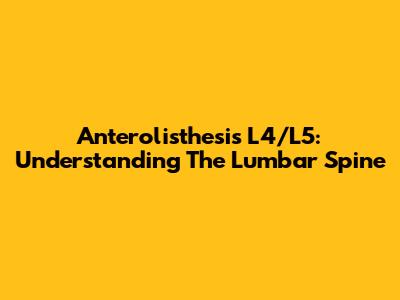 Anterolisthesis L4/L5: Understanding The Lumbar Spine