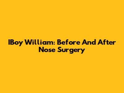 IBoy William: Before And After Nose Surgery