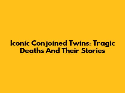 Iconic Conjoined Twins: Tragic Deaths And Their Stories