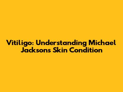 Vitiligo: Understanding Michael Jackson's Skin Condition
